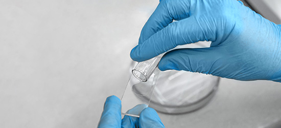 etudes cetelor microbiologie essai